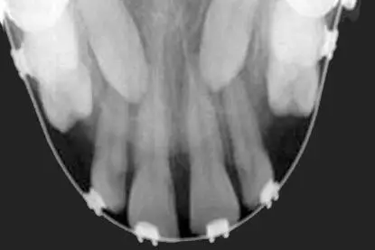 Dental X-Rays in Lagos