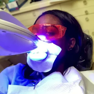 Safe Teeth Whitening in Lagos: Real Costs