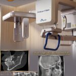CBCT Scan in Lagos