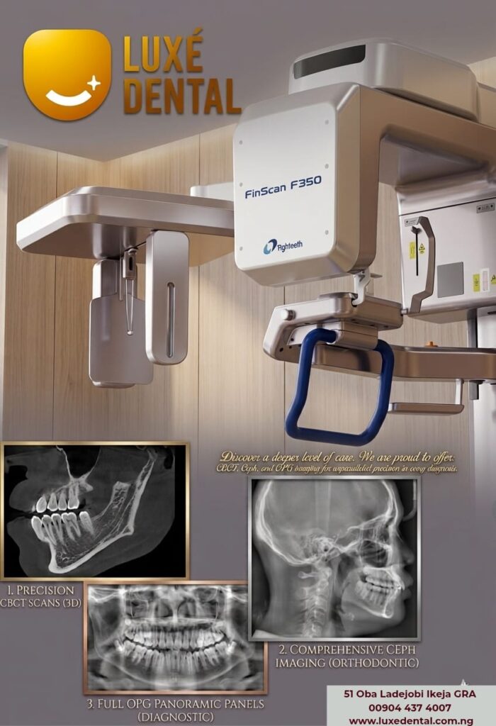 CBCT Scan in Lagos