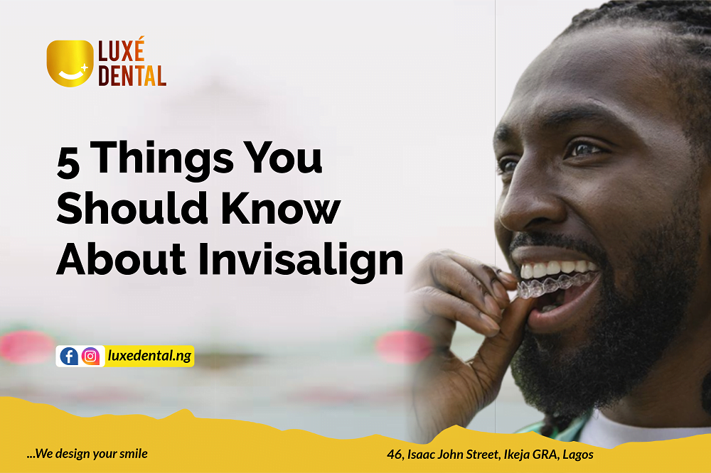 5 Things You Should Know About Invisalign